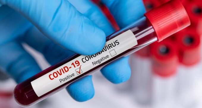 COVID-19 infections surpass 10m globally