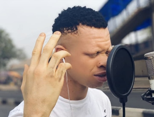 SPOTLIGHT: YellowCee, Nigeria’s ‘first albino rapper’ likened to Dagrin