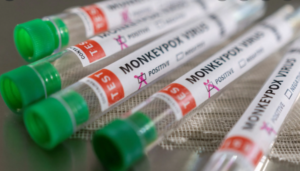 monkeypox tubes