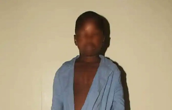 Two suspects at large for removing eye of Bauchi schoolboy