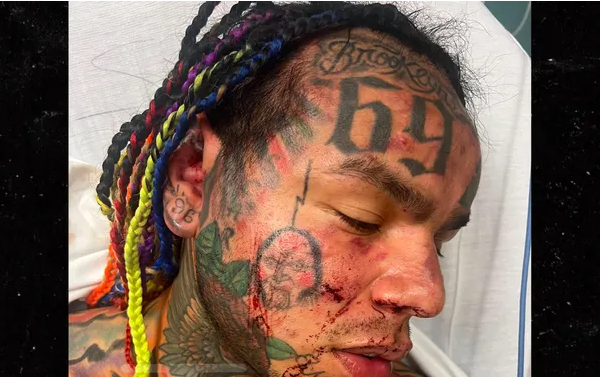 VIDEO: Rapper 6ix9ine hospitalised after being beaten in gym attack